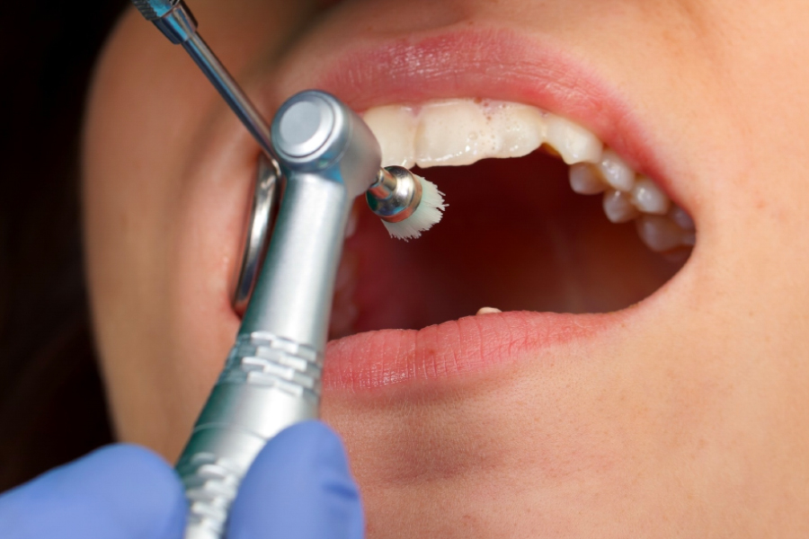 The Role Of Dental Professionals Why Seeking Professional Teeth Whitening Services Is Essential