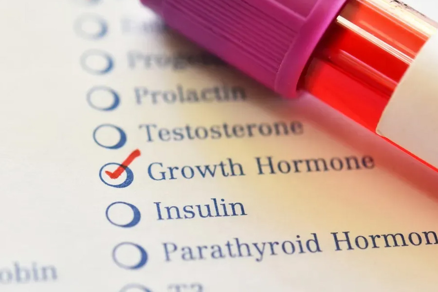 Growth Hormone and Recovery What the Science Actually Says About Sleep Training and Tissue Repair