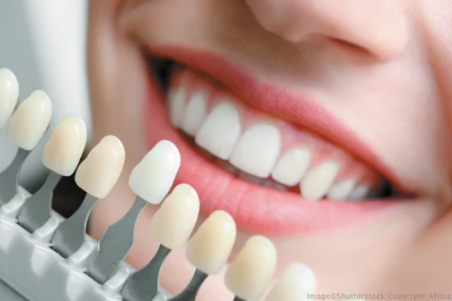 5 Benefits of Cosmetic Dentistry Ottawa