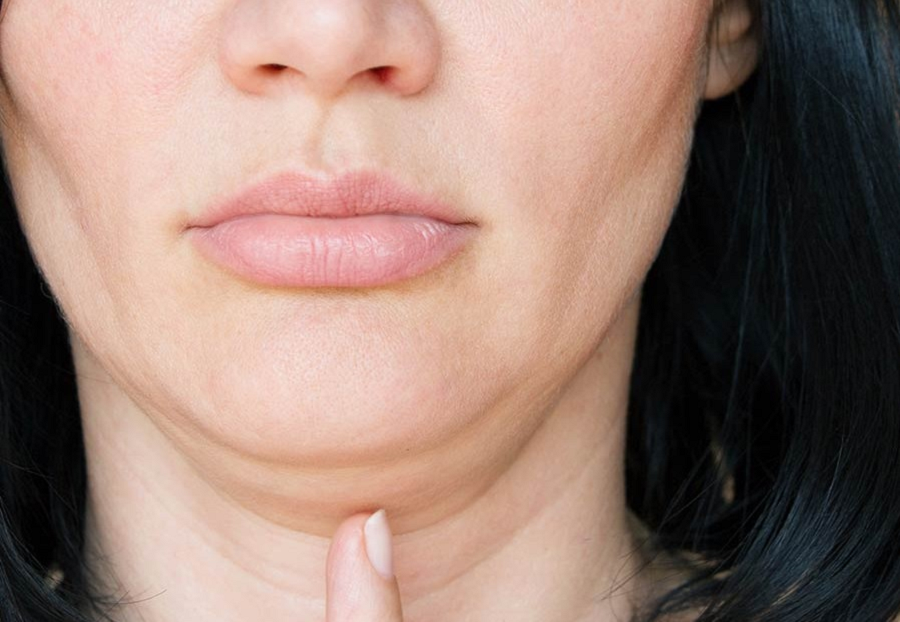 What To Know About Chin Augmentation At Ve’anna Clinic?