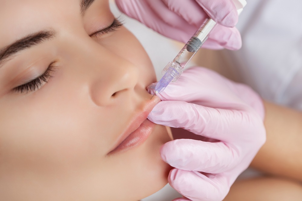 Lip Filler: Amazing Facts To Know Before Getting Lip Injections