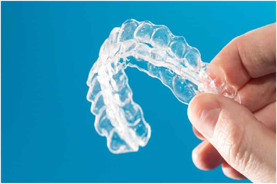 How Do Clear Aligners Function?