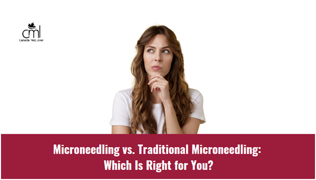 Microneedling vs. Traditional Microneedling:  Which Is Right for You?