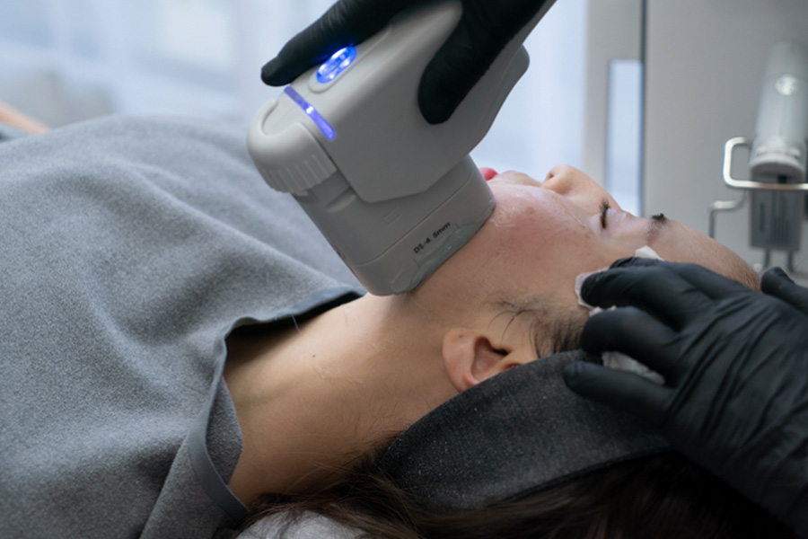 Tried Everything for Acne Scars? Here’s What’s Actually Working